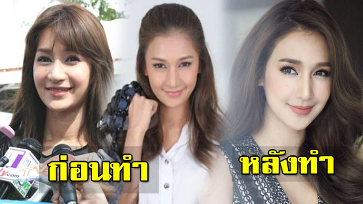 *เกือบทั้งประเทศไม่เคยรู้!!! เผยโฉมหน้า "2ซุปตาร์สาว" ดีกรีนางร้าย-นางเอกชื่อดัง ที่สารภาพผ่านสื่อ เคย "เหลาจมูกออก" ให้เล็กลง!!! (เนื้อหา)