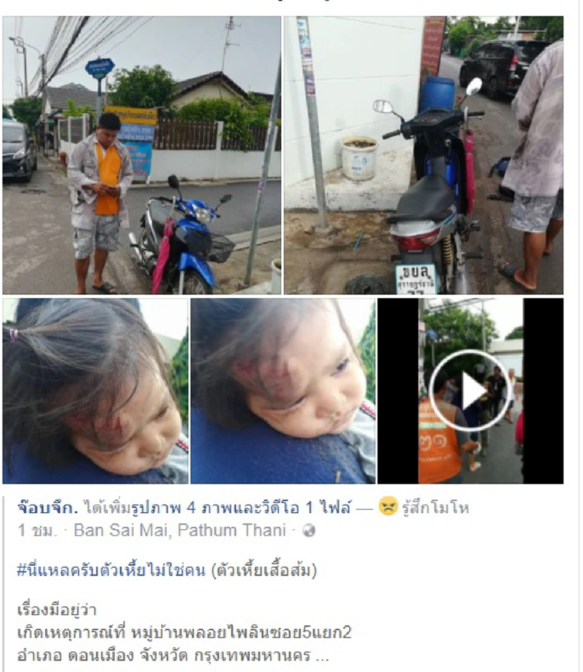 ระดับ"บิ๊กแป๊ะ"ต้องรู้เรื่องแบบนี้!! หนุ่มจวกเดือดมอร์ไซค์แม่โดนปาดหน้าล้มเจ็บตัว แจ้งตร.รอยาว2ชม.ไม่เห็นหัวคู่กรณีเบ่งแอ๊คอ้างไม่ผิด(คลิป)