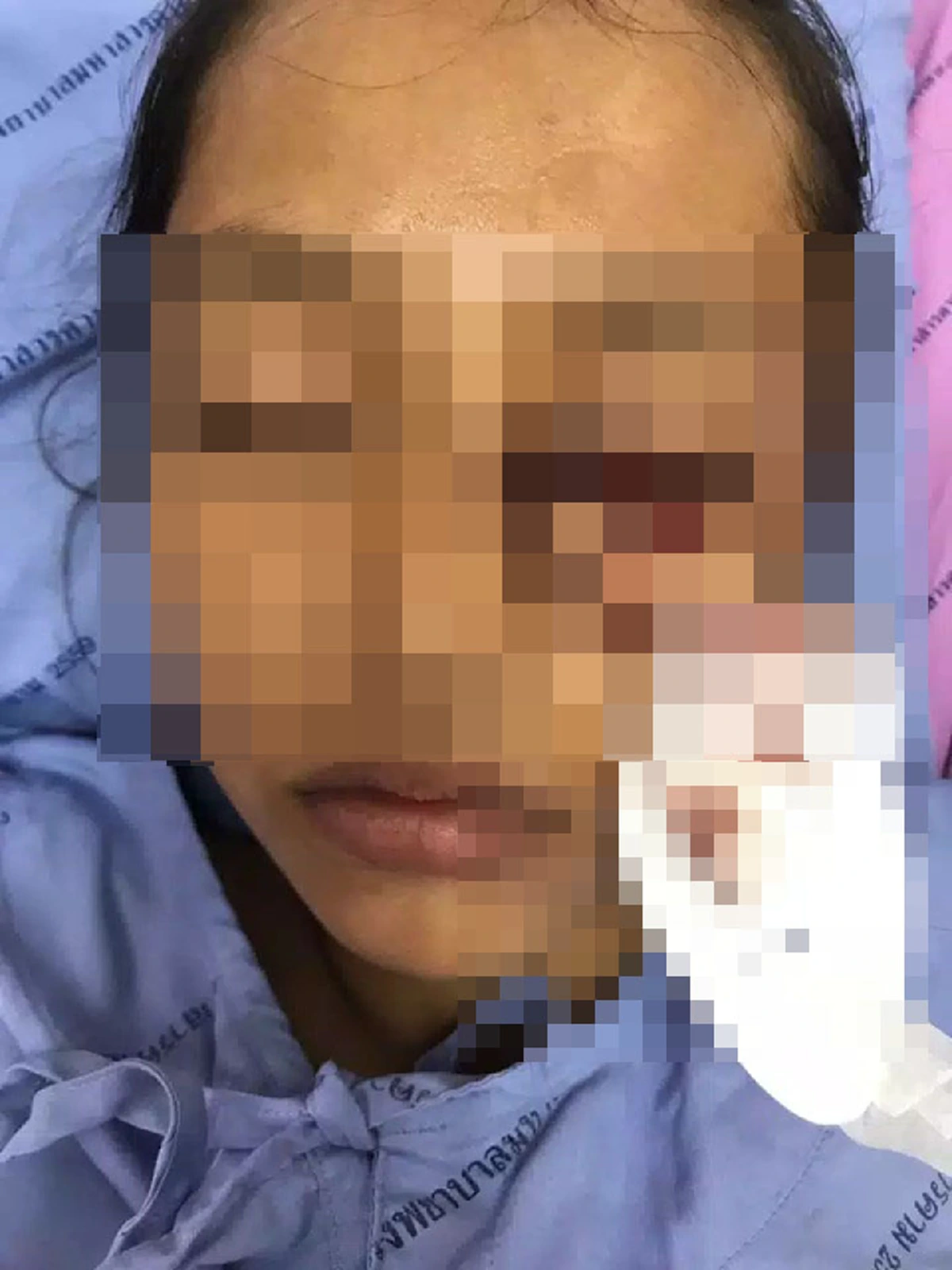 อาการล่าสุดนร.หญิง แนวโน้มตาบอดถาวร