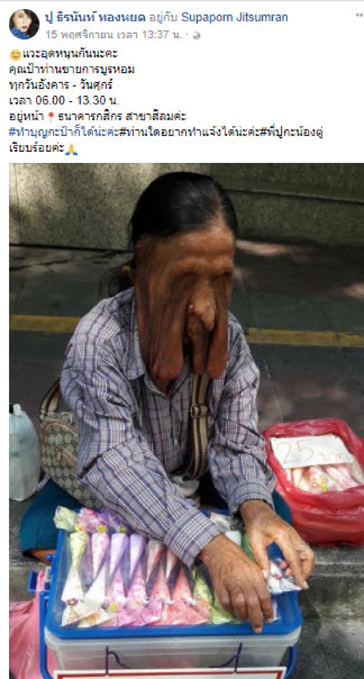 คนไทยไม่ทิ้งกัน !?! ผอ.เลิดสิน รับช่วยผ่าตัดคุณป้าสู้ชีวิต ป่วยก้อนเนื้อย้อยใบหน้า ปิดตามองไม่เห็น แต่ไม่เคยท้อ หาบการบูรขายเลี้ยงชีพ…