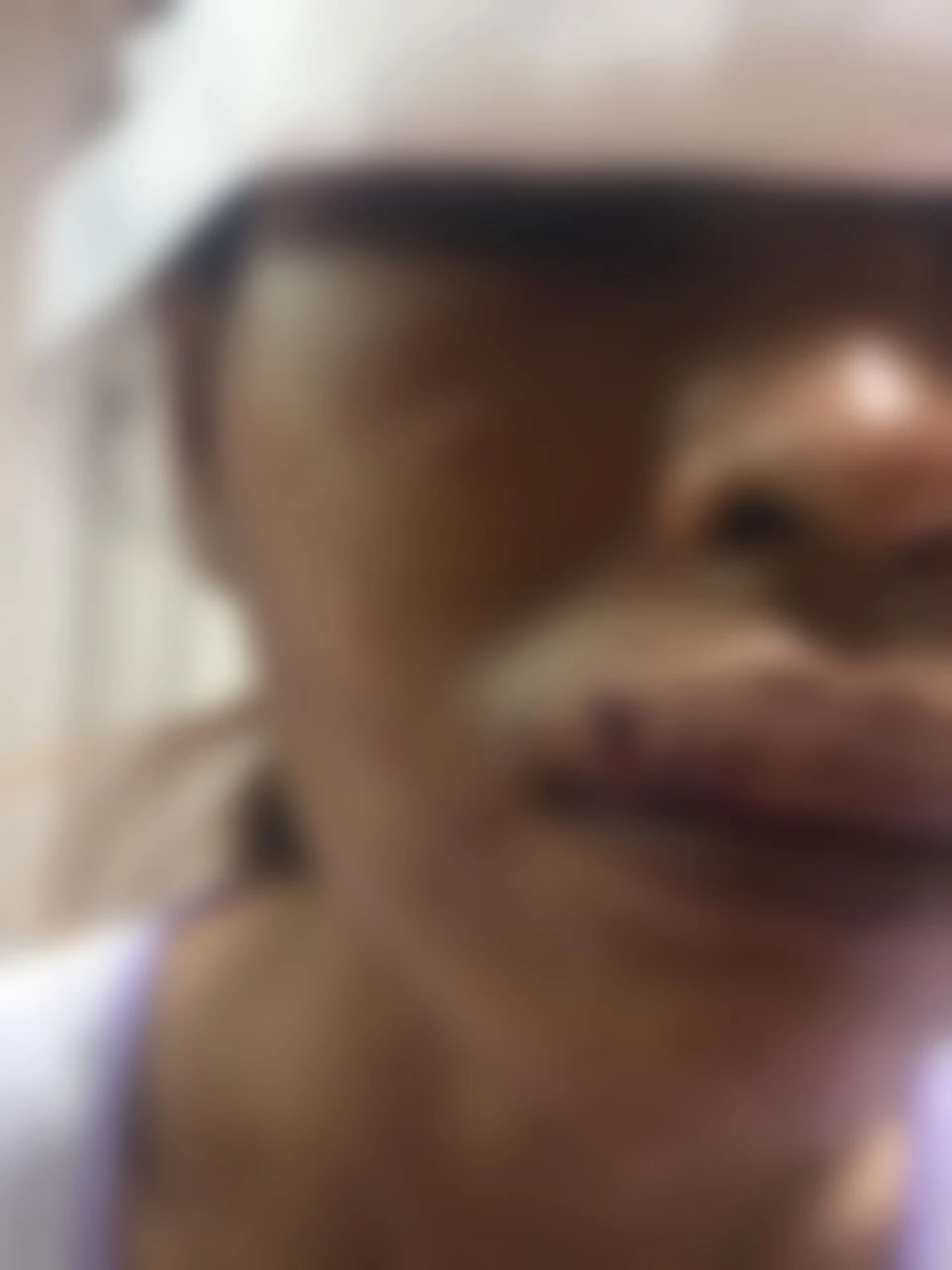 สาวเกิดอุบัติเหตุ กระจกเข้าตา โร่หา "หมอ" แต่สุดท้ายแค่เย็บแผลให้