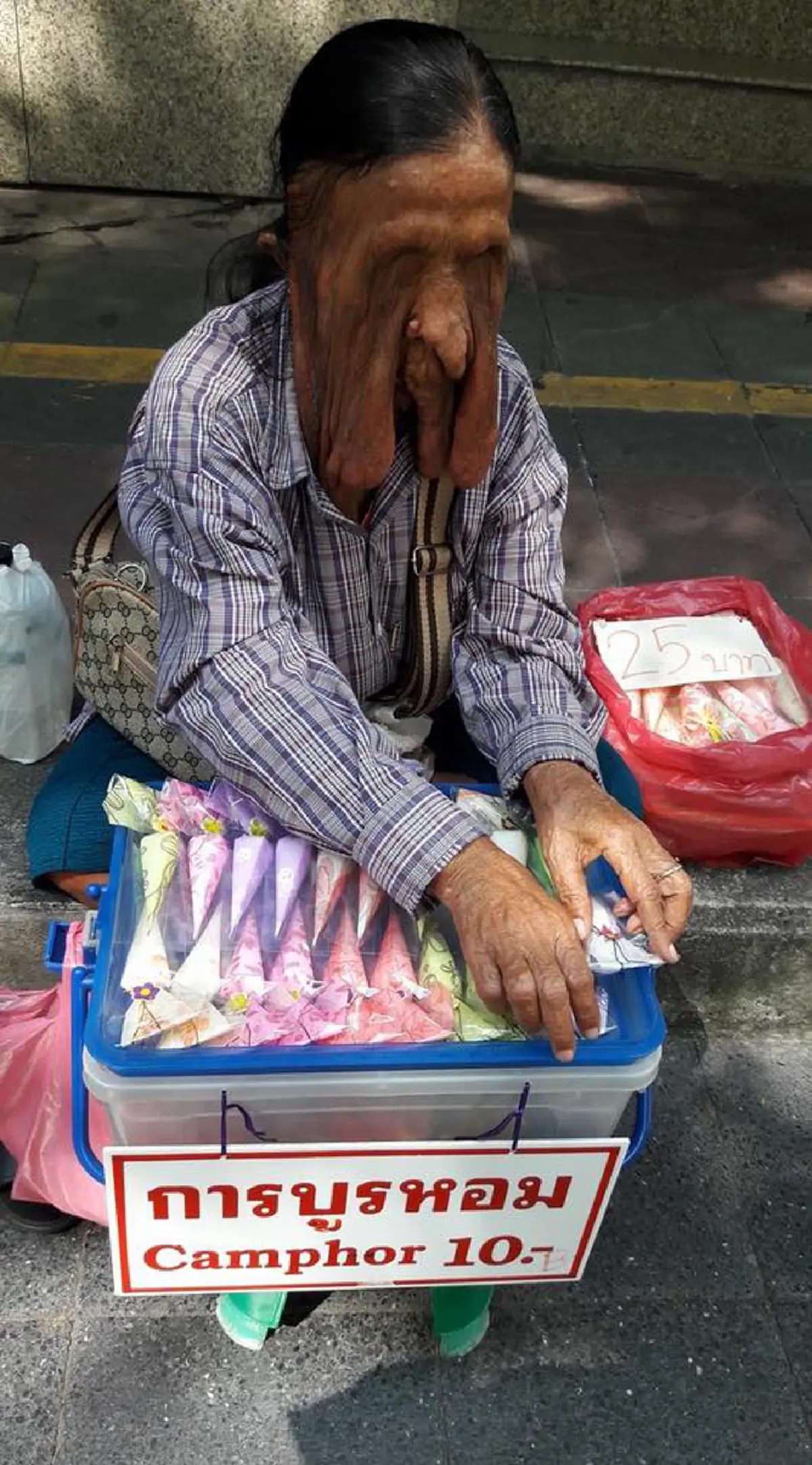 คนไทยไม่ทิ้งกัน !?! ผอ.เลิดสิน รับช่วยผ่าตัดคุณป้าสู้ชีวิต ป่วยก้อนเนื้อย้อยใบหน้า ปิดตามองไม่เห็น แต่ไม่เคยท้อ หาบการบูรขายเลี้ยงชีพ…