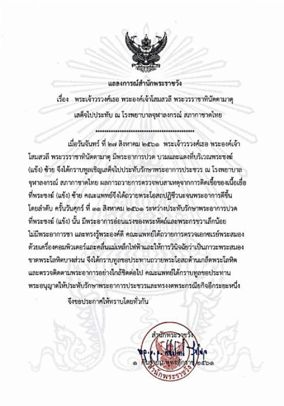 แถลงการณ์สำนักพระราชวัง พระองค์โสม พระสมองขาดพระโลหิต ประทับรพ.จุฬาฯ