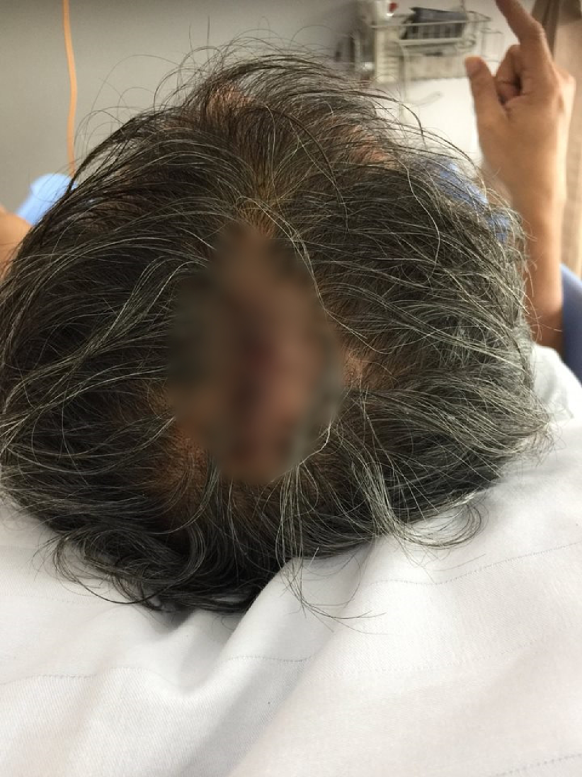 ศุ บุญเลี้ยง เล่าอุบัติเหตุกระเบื้องตกใส่ศีรษะ ในวันต้องรีบไปดูใจน้องสาว ขณะนั่งแต่งเพลงชวนคนออกมาเลือกตั้ง