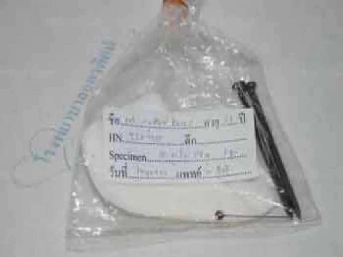 เสกตะปูเข้าท้อง!! เรื่องจริงของมนต์ดำ!! แม้จะเป็นพระ ไม่มียกเว้น ตะปูหลายตัวมาได้อย่างไร? ถึงตาย..ถ้าไม่มีสิ่งนี้มาช่วยไว้!!!