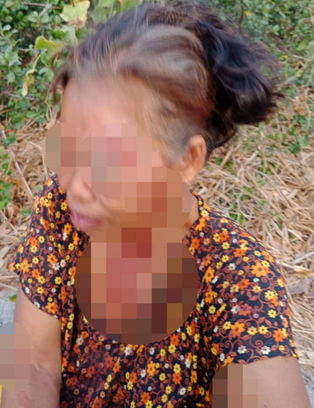 ลูกชายลงมือหนัก แม่เจ็บเกินทนแต่ยังปกป้องบอกเดินซุ่มซ่ามเอง