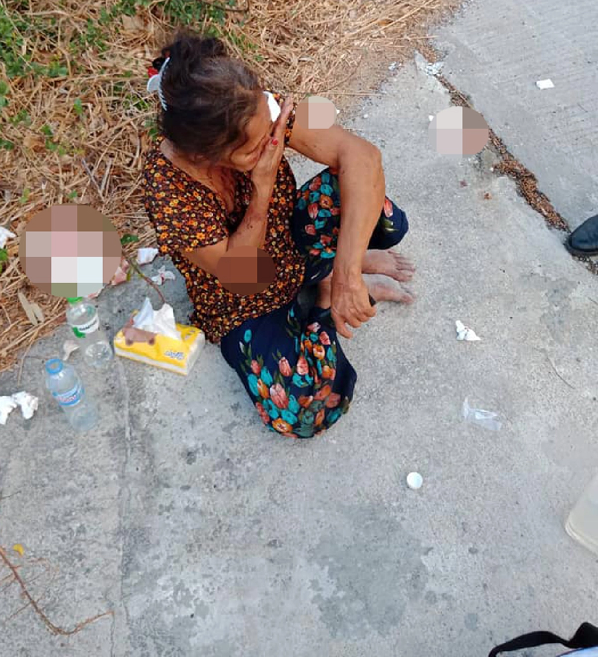 ลูกชายลงมือหนัก แม่เจ็บเกินทนแต่ยังปกป้องบอกเดินซุ่มซ่ามเอง