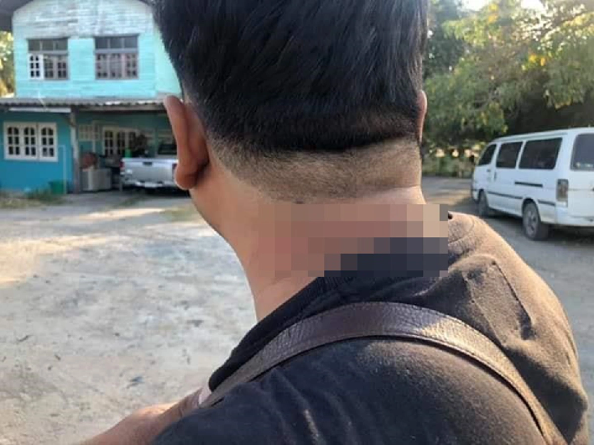 คนร้ายขึงลวดขวางถนน หนุ่มเคราะห์ร้ายขับรถผ่านมาถูกเกี่ยวคอได้รับบาดเจ็บ