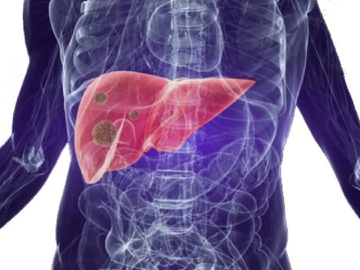 #ห้ามกินเด็ดขาด!! แพทย์เตือน &quot;10 โรค&quot; เสี่ยงติดต่อทางน้ำลาย แค่ใช้หลอดดูดน้ำร่วมกัน ระวังให้ดี! อันตรายใกล้ตัวอย่ามองข้าม!!