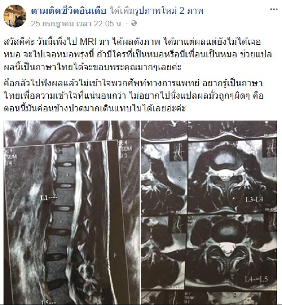 ซึ้งใจสุดๆ!! "น้องขิม" บล็อกเกอร์ชื่อดังป่วยหนักที่อินเดีย แฟนคลับอยากมอบเงินช่วย แต่ "แม่" ขอปฏิเสธไม่รับ พอรู้เหตุผลชาวเน็ตชื่นชมยกใหญ่