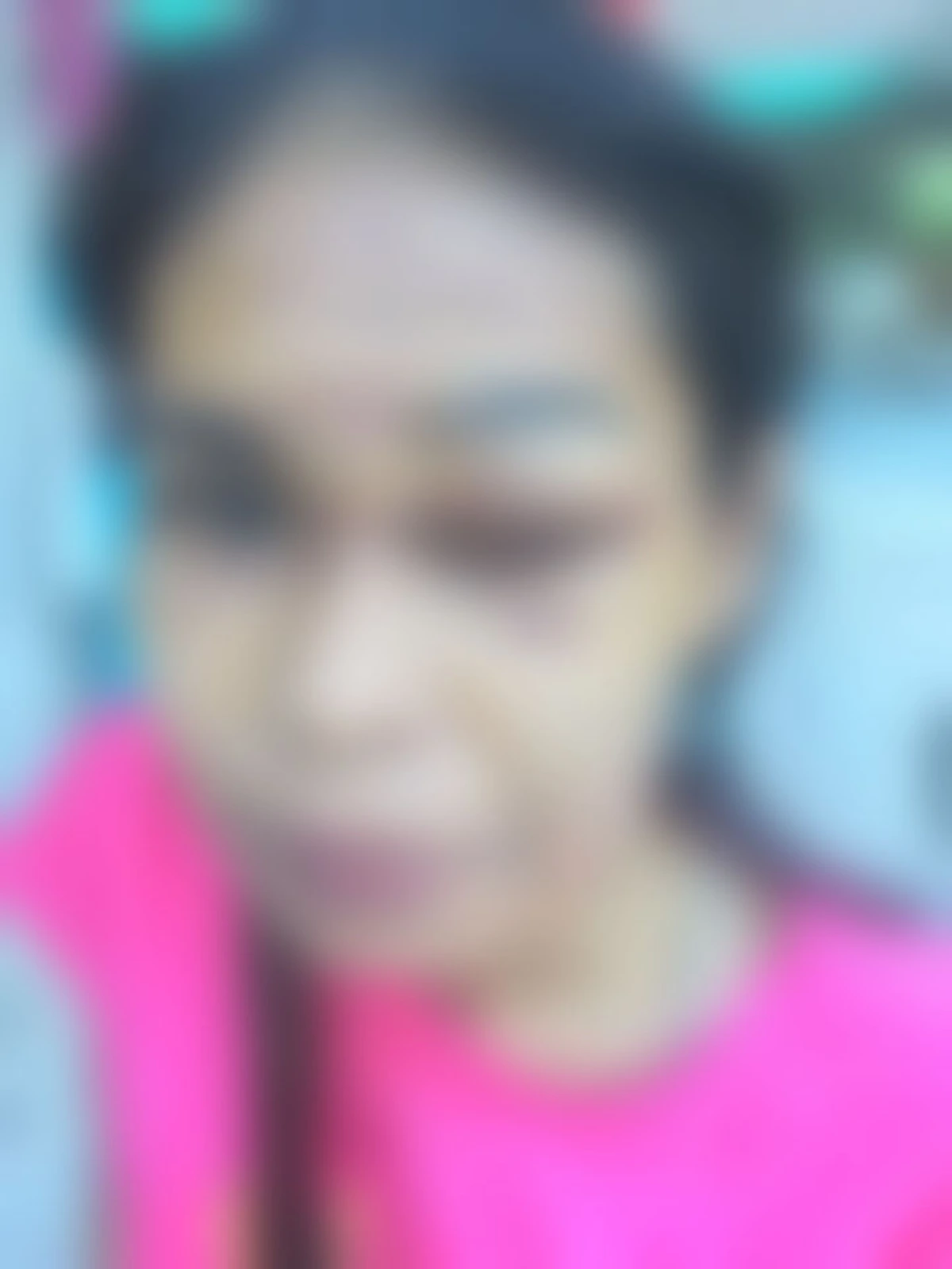 สาวเกิดอุบัติเหตุ กระจกเข้าตา โร่หา "หมอ" แต่สุดท้ายแค่เย็บแผลให้