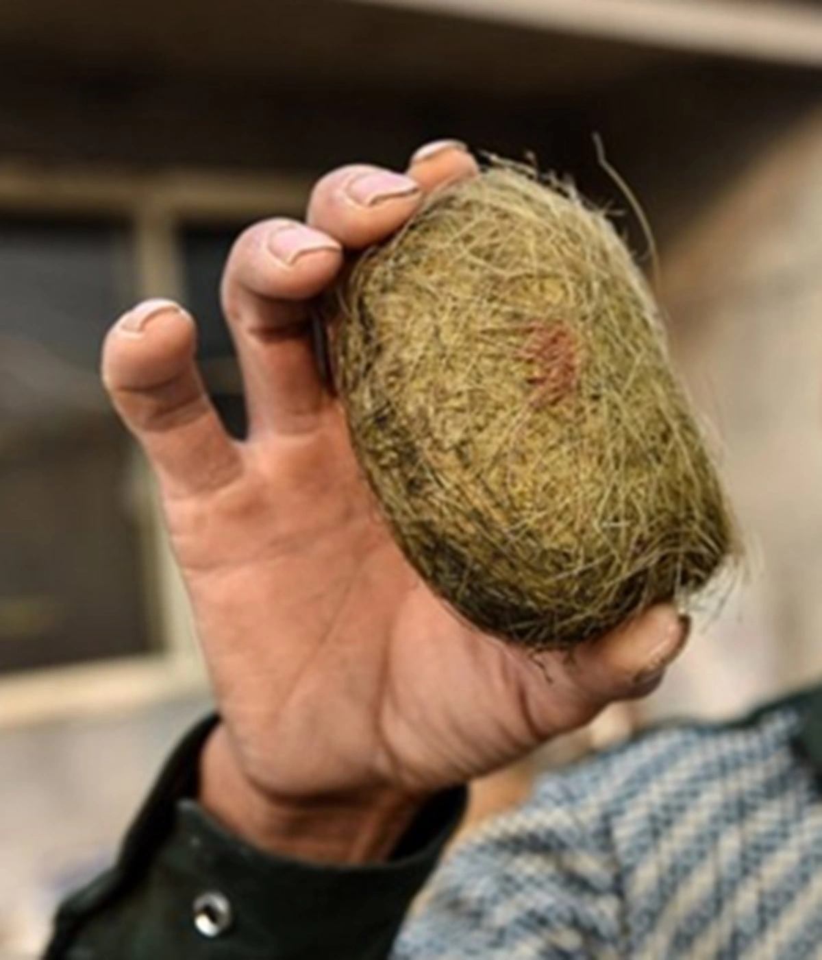 รวยพลิกชีวิต!!! เกษตรกรเจอ "อ้วกหมู" ในถุงน้ำดี ประเมินราคาตามตลาด พบมีมูลค่าสูงถึง 19 ล้านบาท