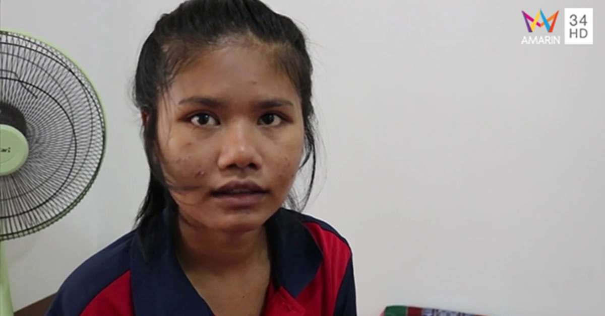 หวิดเสียเงินฟรี7หมื่น "สาวเมืองชลฯ"ร้องทุกข์ เจอหมอ รพ.เอกชน วินิจฉัยสุดมึน ต้องผ่าตัด ขอย้ายไปรพ.ของรัฐ  สรุปเเค่ปวดท้องประจำเดือนรุนเเรง??