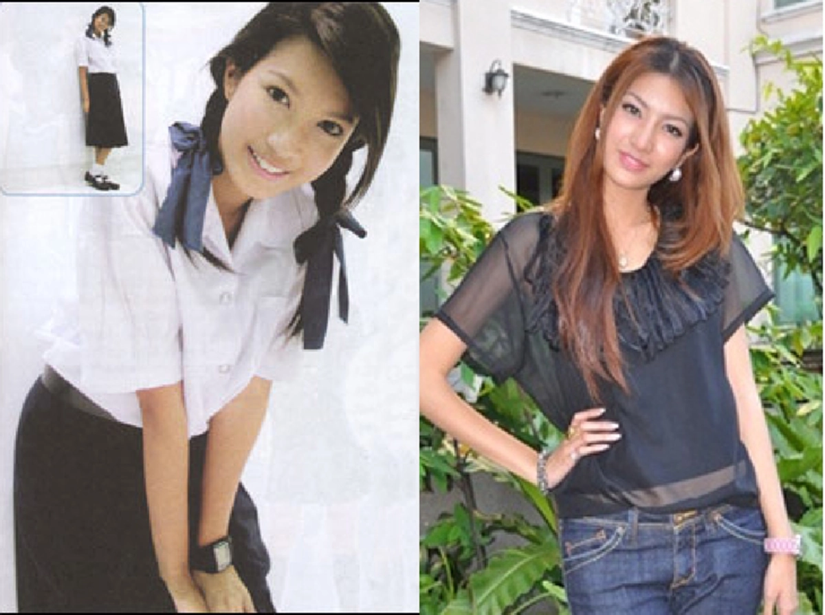 *เกือบทั้งประเทศไม่เคยรู้!!! เผยโฉมหน้า "2ซุปตาร์สาว" ดีกรีนางร้าย-นางเอกชื่อดัง ที่สารภาพผ่านสื่อ เคย "เหลาจมูกออก" ให้เล็กลง!!! (เนื้อหา)