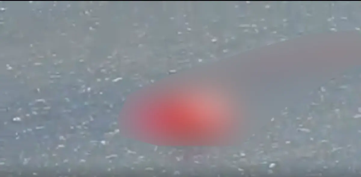 ผวา!!! รถ 18 ล้อชนเด็กชายวัย 14 หัวใจกระเด็นออกมากองบนถนน (รายละเอียด)