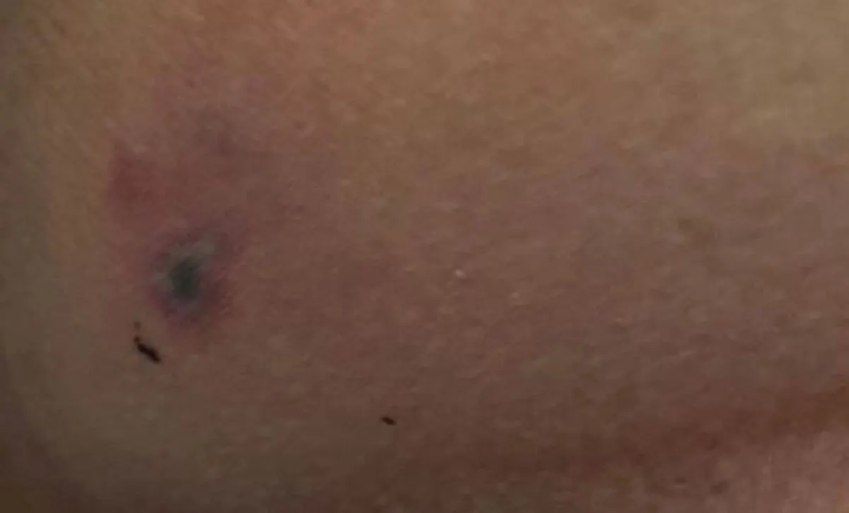 หวีดร้องเสียขวัญ อาจารย์ม.ดังถูกตะขาบยักษ์กัดเป้ากลางห้างฯ โวยไม่ใช่เรื่องเล็กๆ!