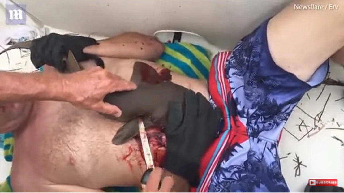 นักดำน้ำ เลือดท่วมร่าง หลังโดนฉลามจู่โจม กัดพุงไม่ยอมปล่อย แม้ขึ้นมาบนเรือ จนเพื่อนตัดสินใจทำในสิ่งที่ไม่คาดคิด ฉลามจึงคลายคมเขี้ยว (คลิป)