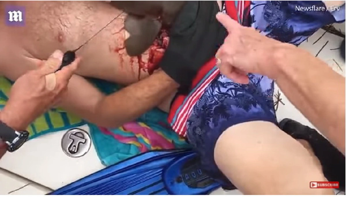 นักดำน้ำ เลือดท่วมร่าง หลังโดนฉลามจู่โจม กัดพุงไม่ยอมปล่อย แม้ขึ้นมาบนเรือ จนเพื่อนตัดสินใจทำในสิ่งที่ไม่คาดคิด ฉลามจึงคลายคมเขี้ยว (คลิป)