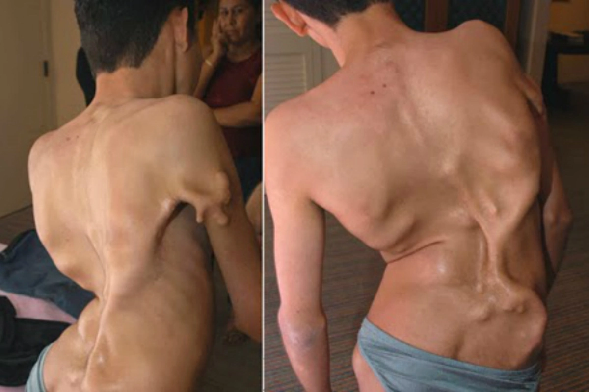 แพทย์ย้ำหนัก!!! ปวดหลังอย่าชะล่าใจ นี้คือสัญญาณเตือนจากร่างกาย รู้ทันโรค อ่านด่วน!!!