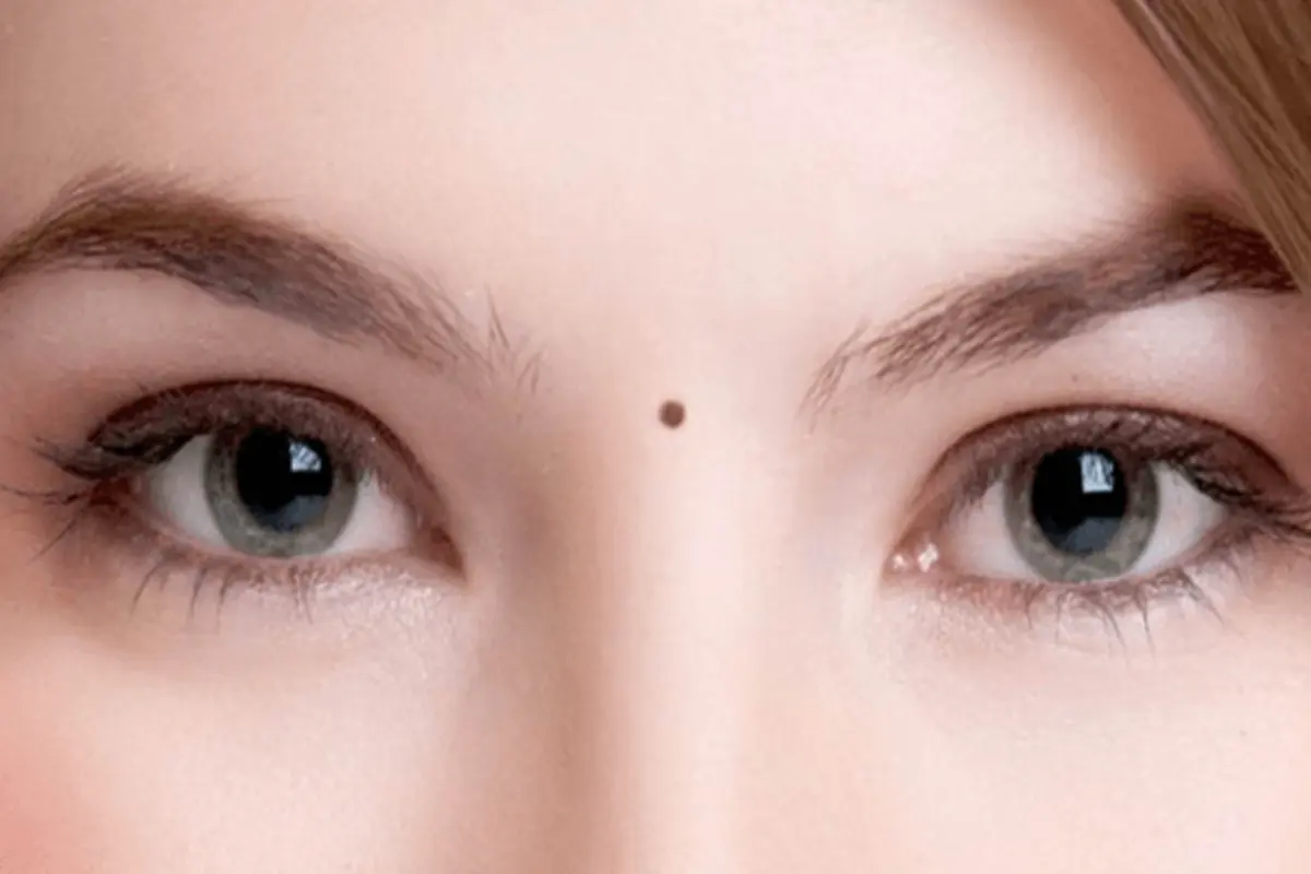 รู้แล้วบอกต่อ!! ตำแหน่ง "ไฝ" ตามความเชื่อโบราณ ที่ส่งผลต่อชีวิตแบบไม่รู้ตัว