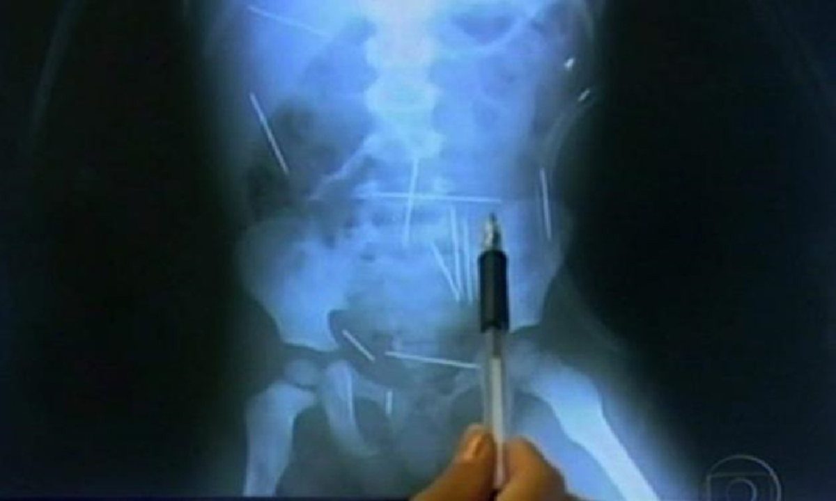 หากว่า ไสยศาสตร์  ไม่ใช่เพียงความเชื่อ !?! ความจริงเรื่อง คุณไสย  ในอดีต ที่เกิดขึ้นจนเป็นข่าวโด่งดังทั้งไทย และต่างประเทศ !!!