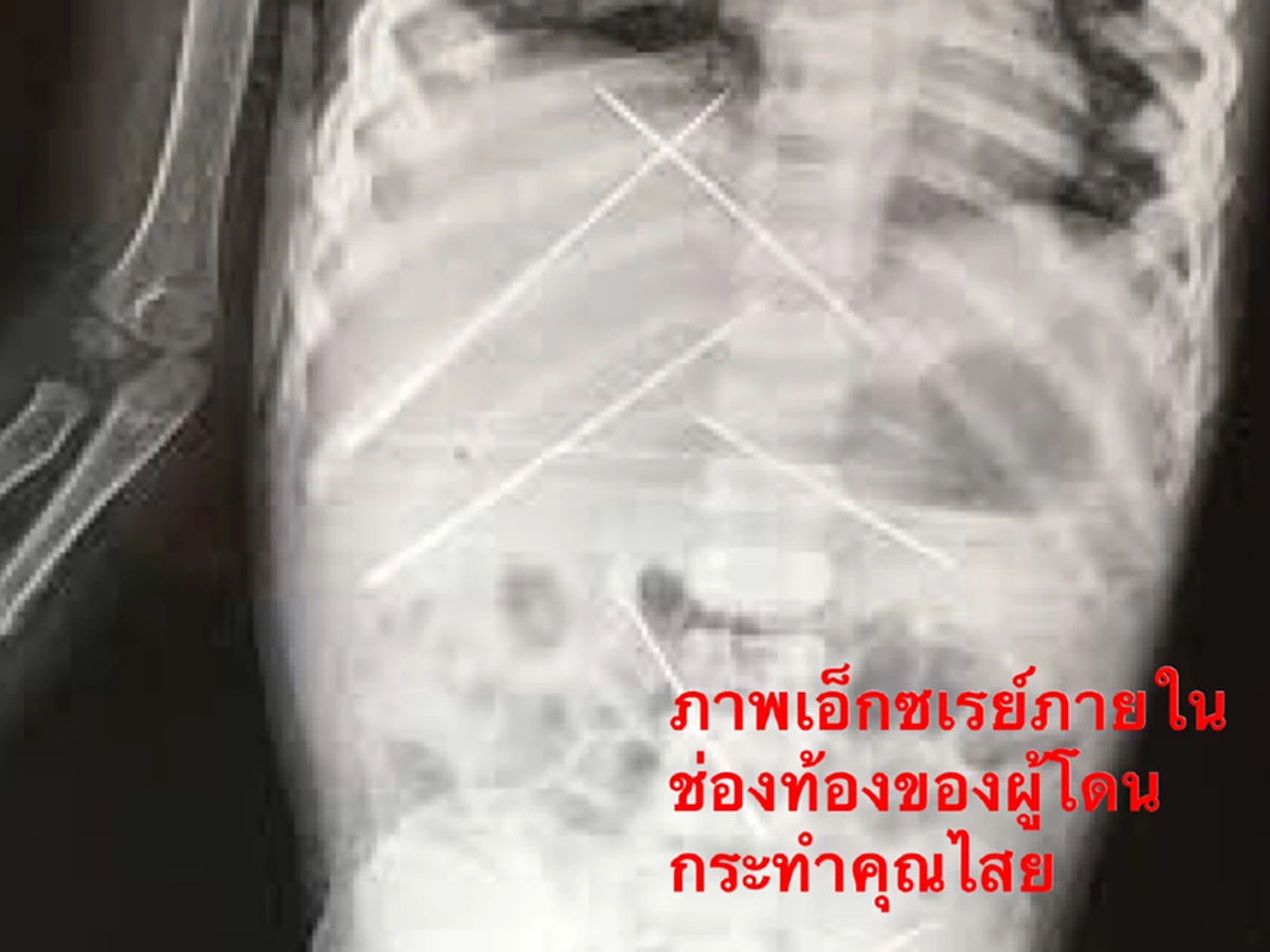 มนต์ดำเขมร สิ่งลี้ลับที่จับต้องไม่ได้ แต่ทำให้คนตายมานักต่อนัก ปัจจุบันยังมีหลงเหลือให้เห็น ในรูปแบบดังต่อไปนี้...