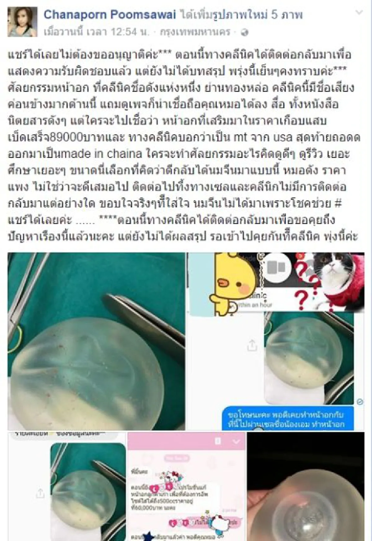 เคลียร์เลย..ด่วนด้วย!! อุทาหรณ์สาวเสริมทรง จ่ายเงินทำนมเหยียบแสนตกลงคุณภาพ USA แต่พอมีปัญหาควักออกมาเจอคาตาเมดอินจีนแดง??