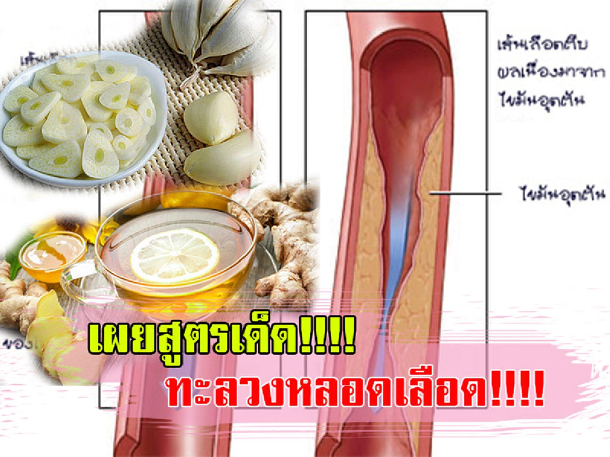 สูตรเด็ด!!!! เผยเคล็ดลับภูมิปัญญาโบราณ  ทะลวงหลอดเลือด เพียง 2 นาที (รายละเอียด)
