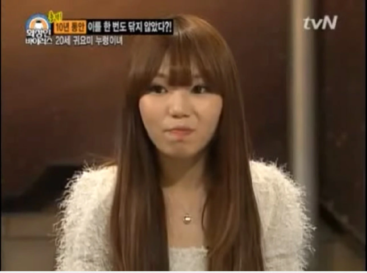 สาวคนนี้ "ไม่แปรงฟัน" นาน 10 ปี! และนี่คือสภาพภายในปากของเธอ !!