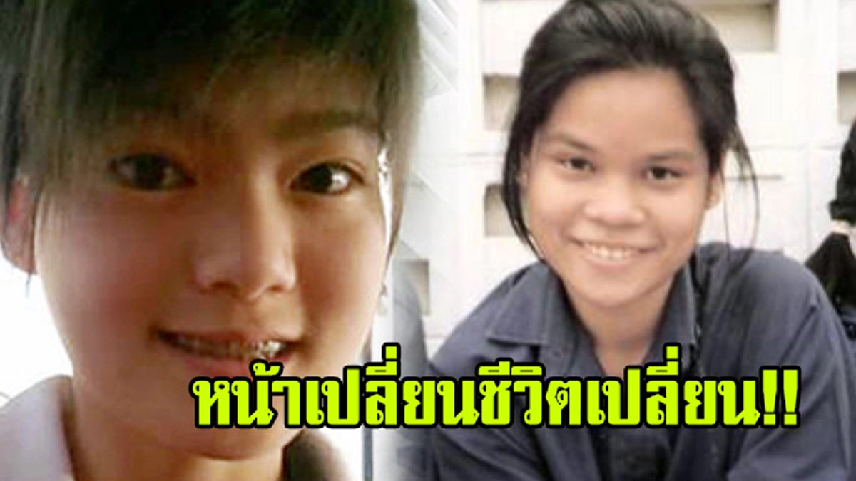 ทึ่งทั้งประเทศ!!! เปิดภาพ"10 ซุปตาร์ของไทย" ที่ขอพึ่งศัลยกรรม ทำจมูกจนโด่ง กลายเป็นดาวประดับวงการบันเทิง!! (ชมภาพ)