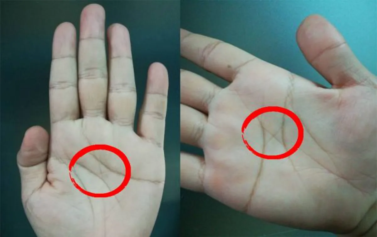 เส้นกากบาท สัญลักษณ์บนฝ่ามือ ที่บอกว่า คุณคือคนที่โชคดีที่สุด!