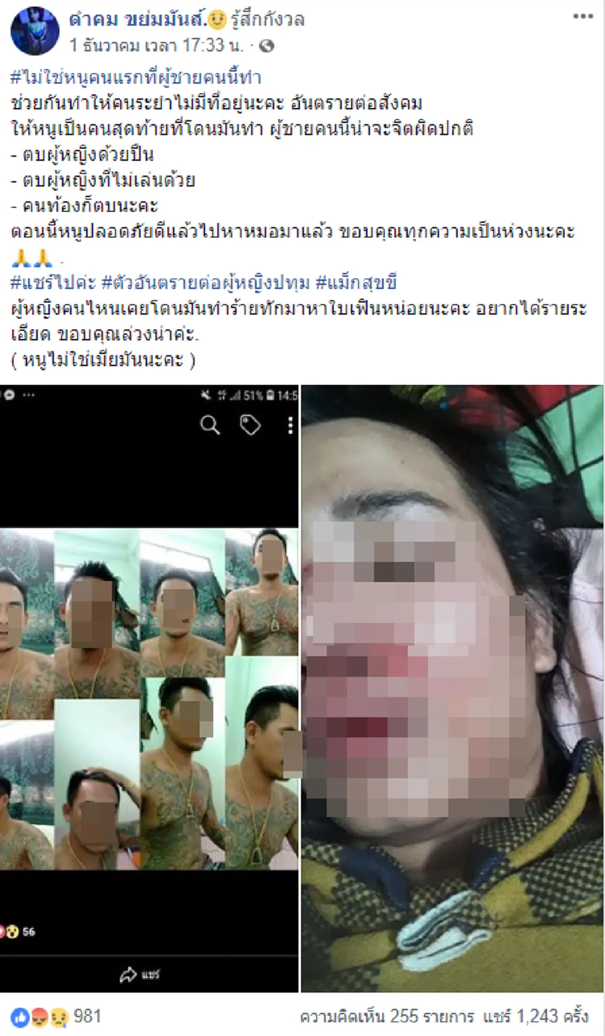 สาวโพสต์เตือน อ้างหนุ่มตามจีบแต่ไม่เล่นด้วย โดนตบเลือดอาบ