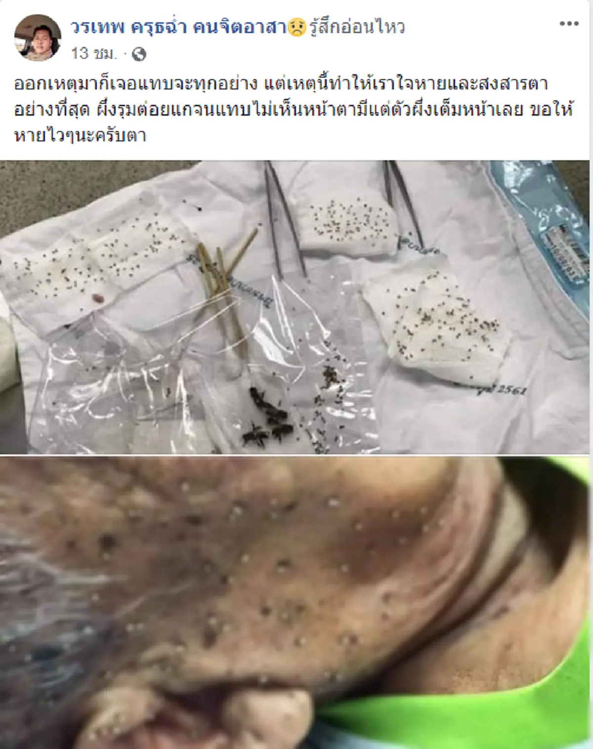 ชายชราถูกผึ้งต่อย ใบหน้าเต็มไปด้วยเหล็กใน ไม่หวั่นพิษขอสู้สุดแรง 