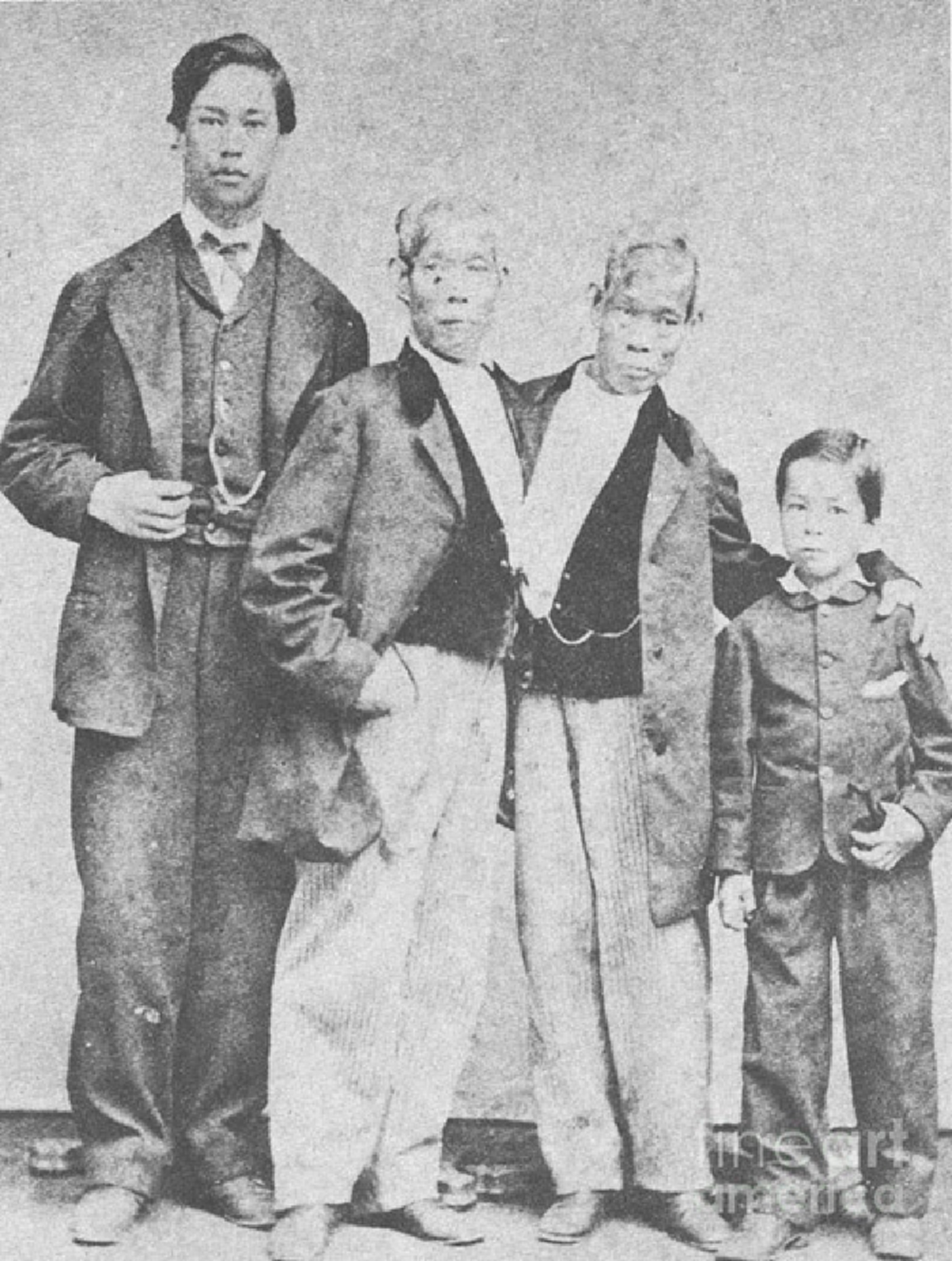 เปิดประวัติเรื่องราวมากมาย ที่หลายคนอาจไม่เคยรู้มาก่อน !!! ตำนาน แฝดสยาม "อิน จัน" พี่น้องที่มีชื่อเสียงที่สุดในโลกขณะนั้น !!!