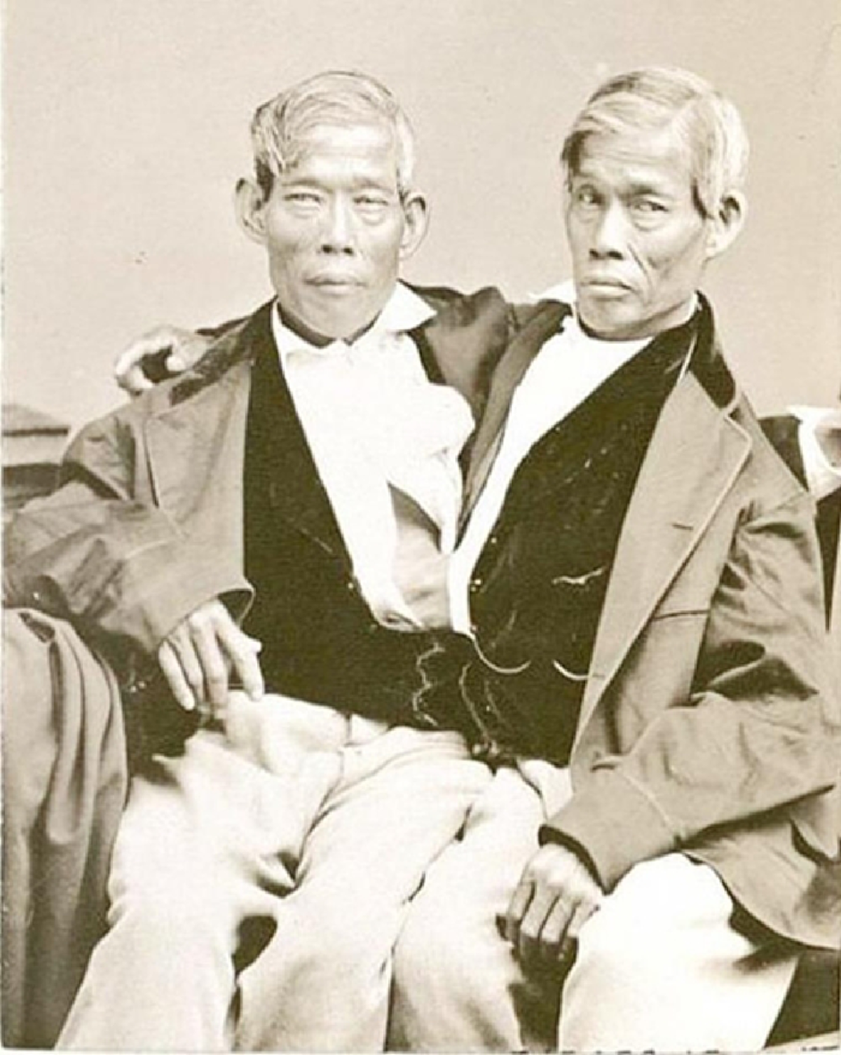 เปิดประวัติเรื่องราวมากมาย ที่หลายคนอาจไม่เคยรู้มาก่อน !!! ตำนาน แฝดสยาม "อิน จัน" พี่น้องที่มีชื่อเสียงที่สุดในโลกขณะนั้น !!!