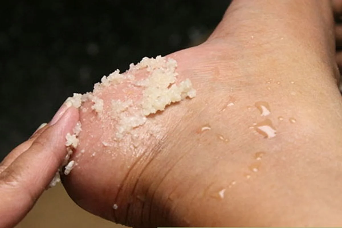 เผยสูตรสครับรักษา "ส้นเท้าแตก" ทำง่าย ไม่ต้องเสียเงินซื้อครีมแพงๆ