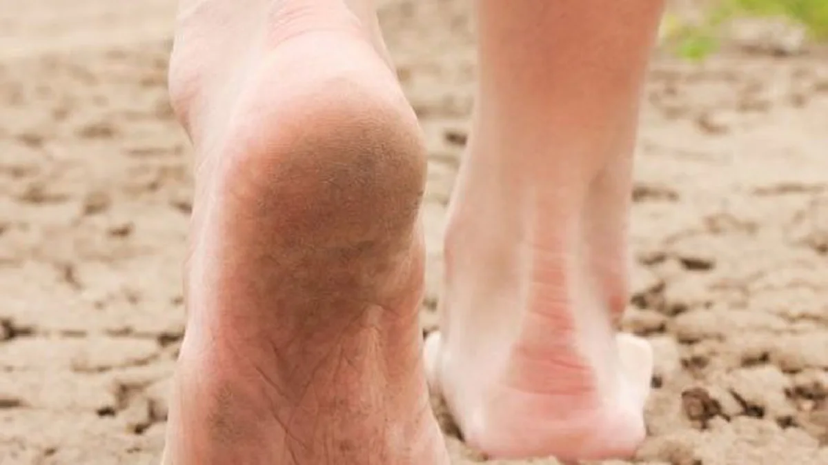 #บอกลา..ได้เลย..!! "ปัญหาส้นเท้าแตก" แก้ไขได้ง่ายๆ !! เพียงแค่ใช้เปลือกกล้วย !!