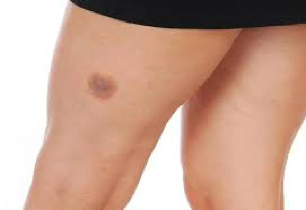 เช็คกันด่วนๆเลย!!! กับ 9 ตำแหน่ง "ปานมงคล" หากใครมีบนร่างกายตามจุดต่อไปนี้... ถือว่าโชคดี จะร่ำรวย ชีวิตสุขสบาย!?