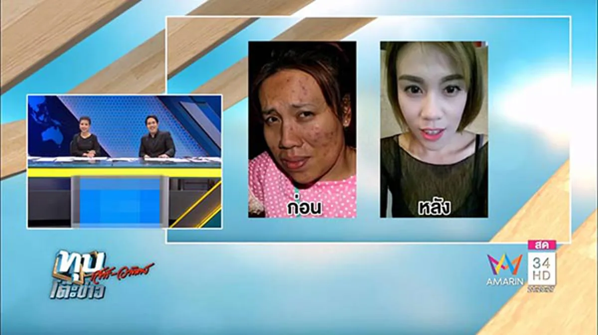 ฮึดสู้เพราะคำดูถูก!! สาวขี้เหร่ที่โจรไม่กล้าข่มขืน เปิดใจ! หลังผ่านมา 2 ปีโดนซ้ำเติมหน้าตา ล่าสุดผลิกโฉมตัวเองจนสวยปิ๊งลบคำสบประมาทหมดสิ้น!?