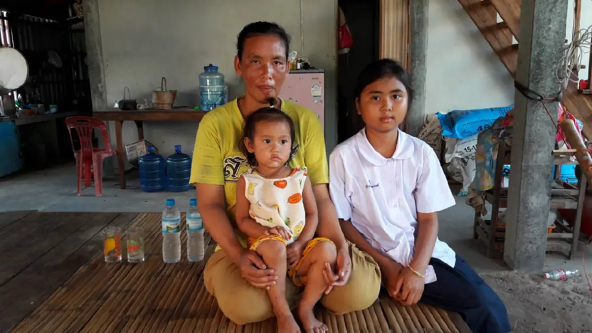 ถึงกับอึ้ง!!! สาวท้องโตผิดปกติ คิดว่าเป็นเนื้องอก ไปตรวจหมอบอกตั้งครรภ์ งงทำหมันแต่ท้อง