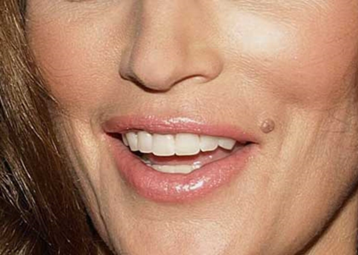 เช็คด่วน!!! "หมอเค้ก" เผย "ขี้แมลงวัน ไฝ ปาน" ขึ้นตำแหน่งไหนวาสนาดี ตำแหน่งไหนอาภัพอับโชค