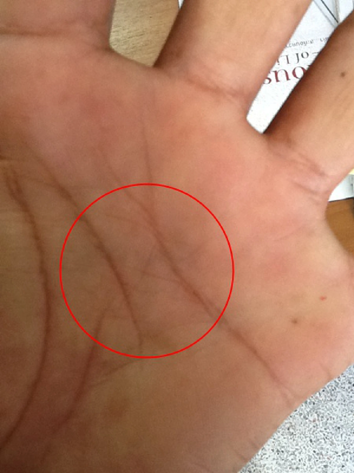 ตัวอย่างเส้นกากบาทกลงฝ่ามือ