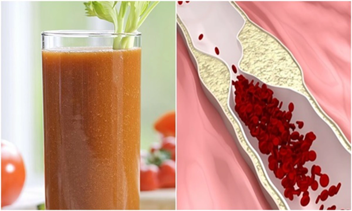 อยากสุขภาพดีต้องดู!!! สูตรน้ำผักสมุนไพรช่วยดักจับและล้างไขมันในเส้นเลือด ลดความดันและน้ำหนัก ทำเองได้ง่ายๆ เห็นผลแน่นอน