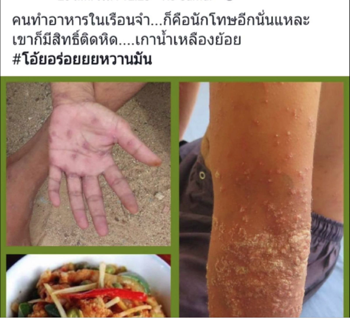 เคลียร์ชัด...เรือนจำสมุยโต้!! แพทย์ร.พ.ดังโพสต์เฟซบุ๊กอันตรายหากนำคนเป็นหิดมาปรุงอาหาร ด้าน ผอ.เรือนจำ ย้ำไม่มีแน่