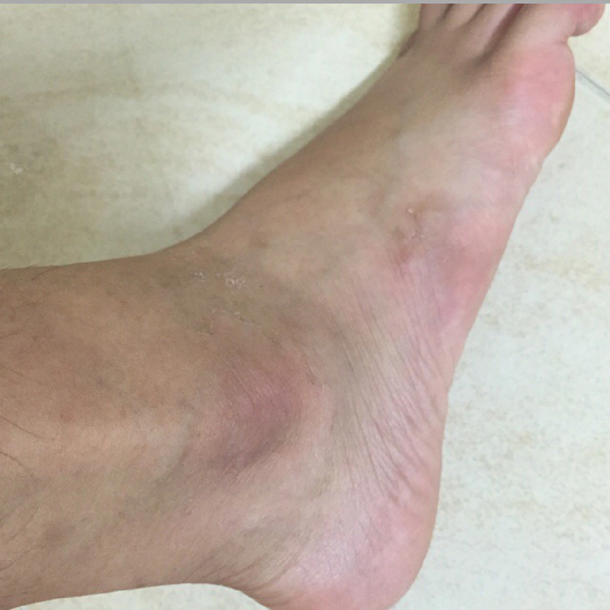 หายโง่ทันทีทันควัน!! เผยเคล็ดลับเด็ด "แก้ปัญหาตาตุ่มด้านดำ" ทำง่ายๆแค่ปลายนิ้ว แต่ได้ผลลัพท์สุดเจ๋ง แถมไม่ต้องเสียเงิน แม้แต่บาทเดียว!!?