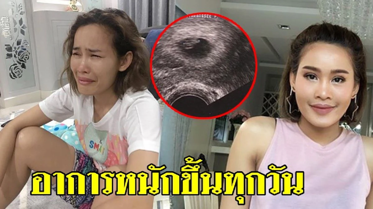 เครียดจัดทนไม่ไหว "หนูเล็ก ก่อนบ่าย" แจงยิบเจอดราม่าแพ้ท้องหนัก ให้สามีไปขายของ เพราะไม่มีงานไม่มีเงิน