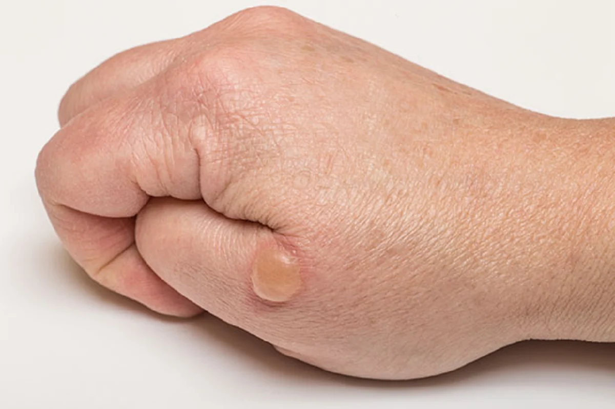 "15 ความฝัน" ที่บ่งบอกว่าคุณกำลังมีโชค เงินทองวิ่งเข้าหา รับทรัพย์ก้อนโต