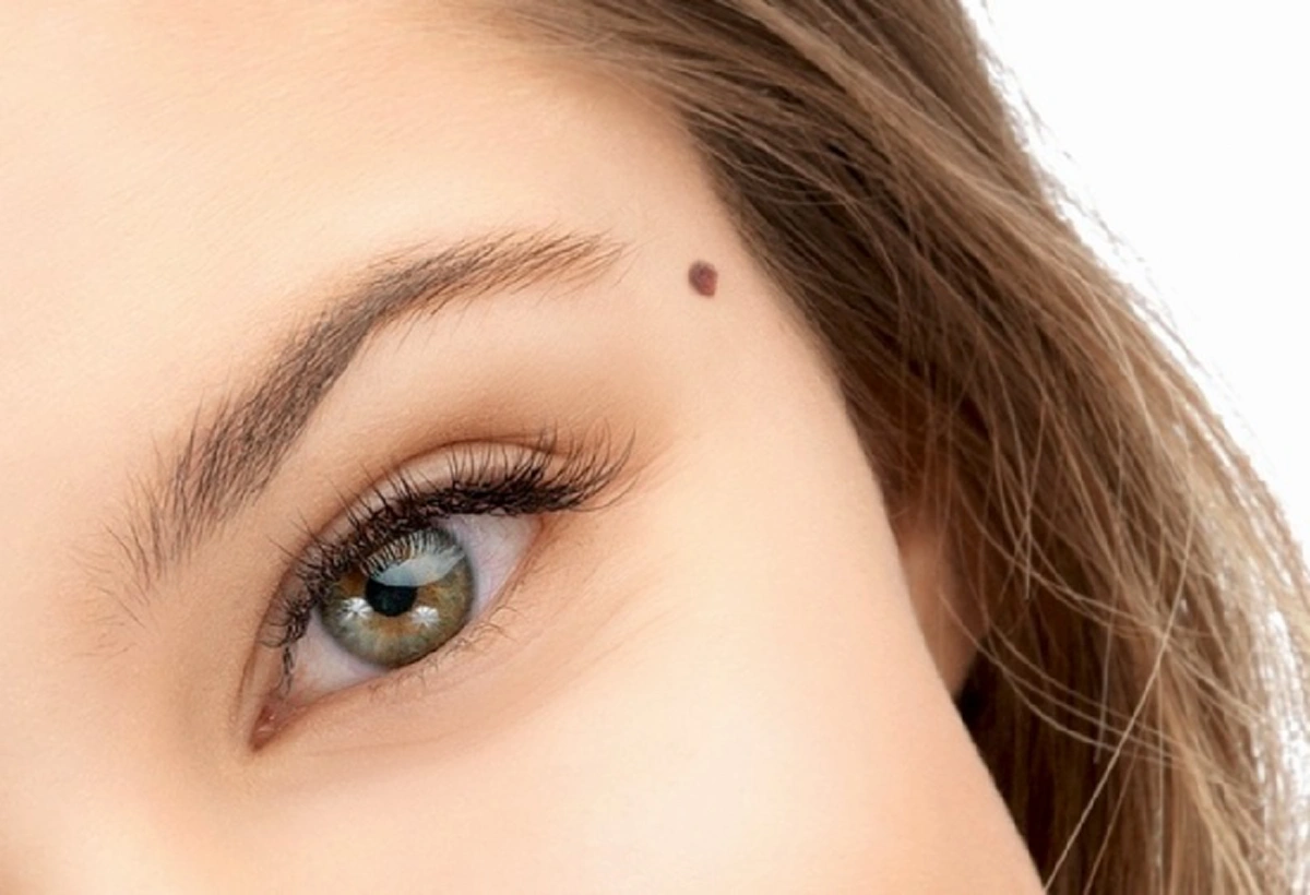 เช็ค! ตำแหน่งไฝดี-ไฝไม่ดี 67จุด บอกนิสัยได้จริง โคตรแม่น!!!! (รายละเอียด)