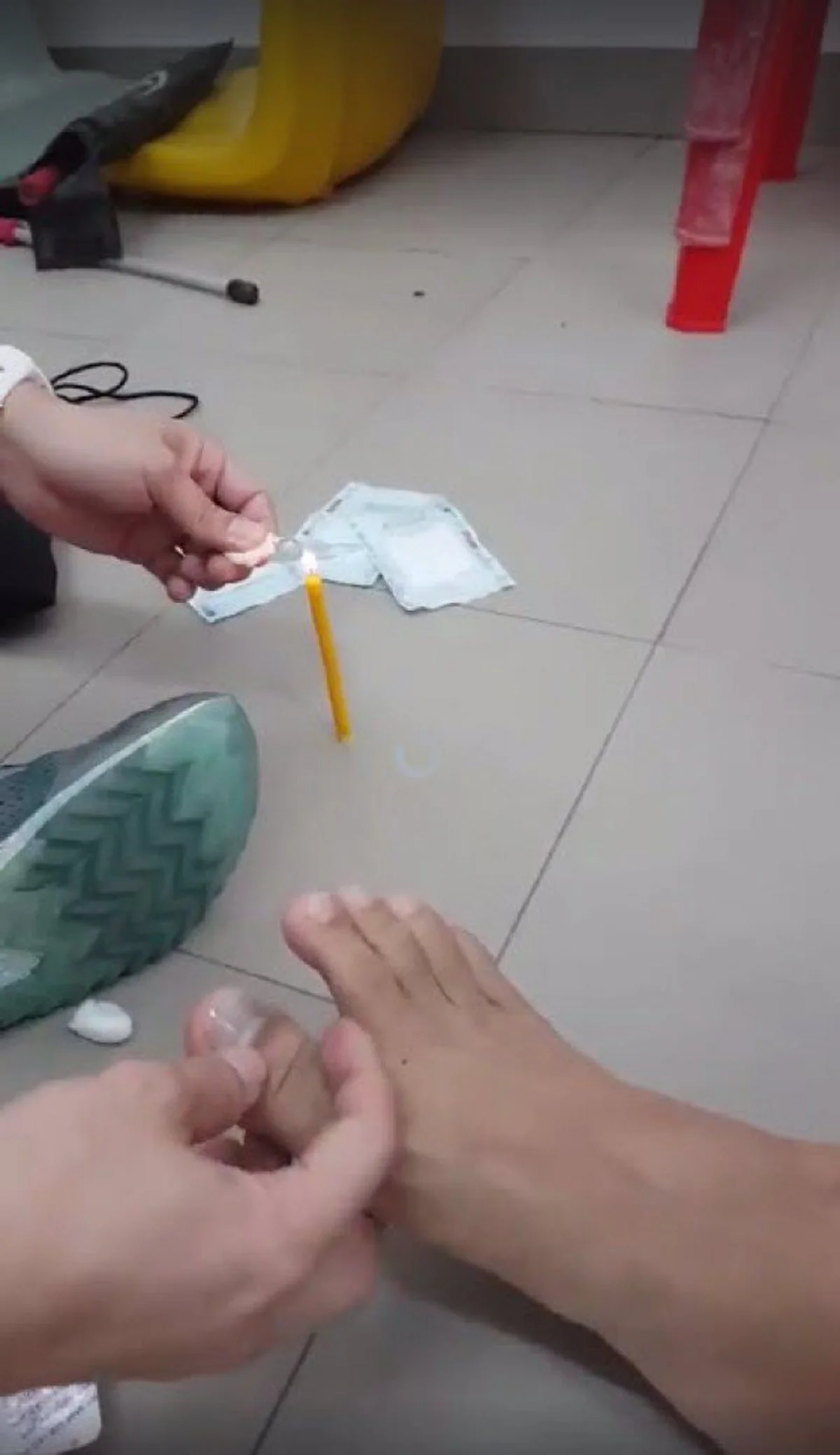 สาวโพสต์คลิป วิธีแก้ปัญหาเล็บฝัง เล็บม่วง ด้วยวิธีบ้านๆ ไม่ต้องทนปวดอีกต่อไป