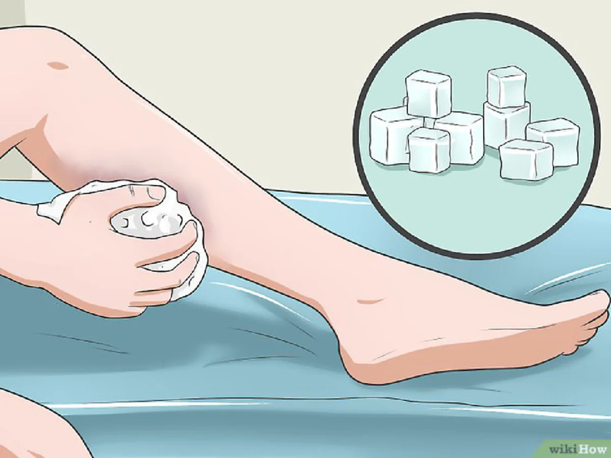 หมอแนะเทคนิคง่ายๆ ความแตกต่าง ประคบร้อน-เย็น